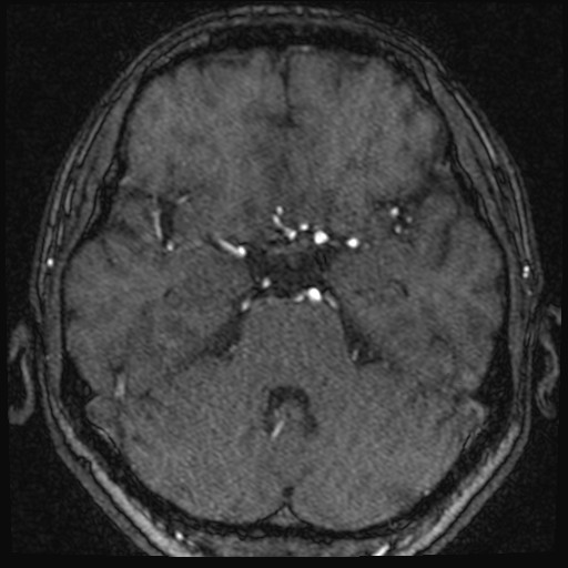 Click on the Serie image to view the images of VILLANUEVA, WILLIAM A.